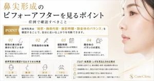 鼻尖形成のビフォーアフターを見るポイント｜症例で確認すべきこと