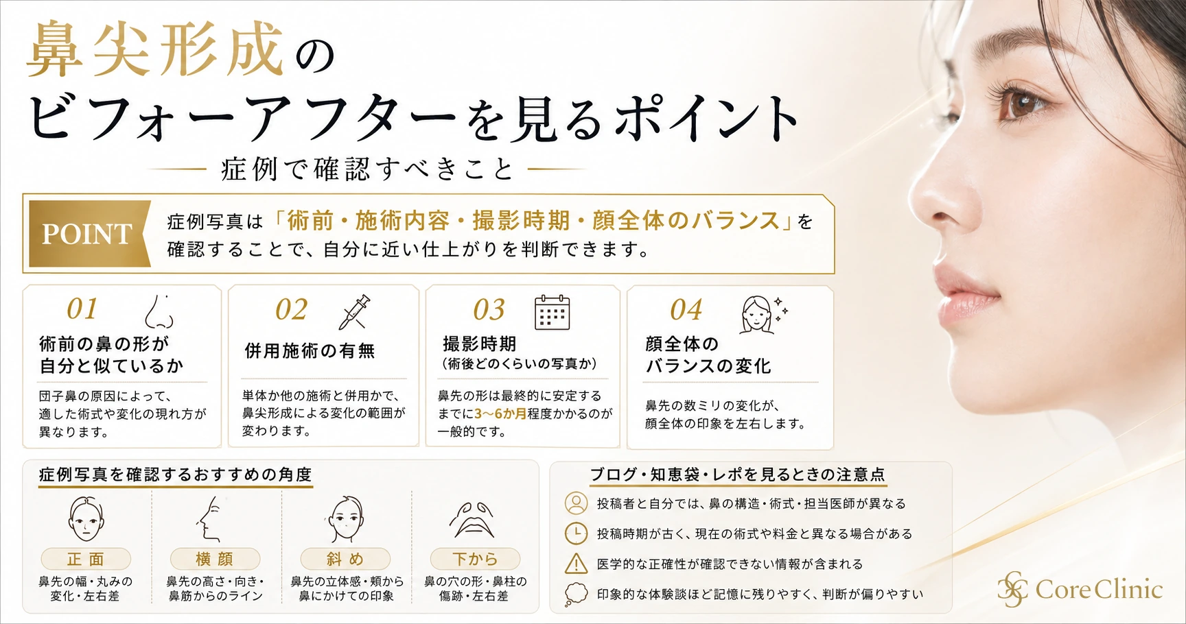 鼻尖形成のビフォーアフターを見るポイント｜症例で確認すべきこと
