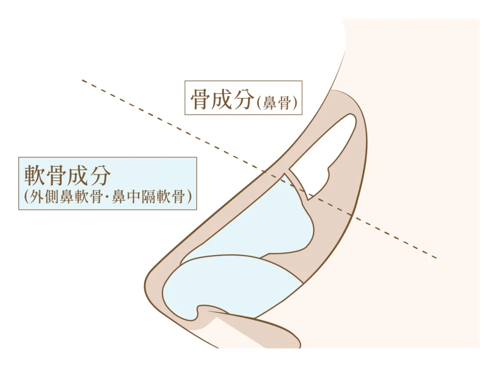 鷲鼻になる原因についての図解解説画像