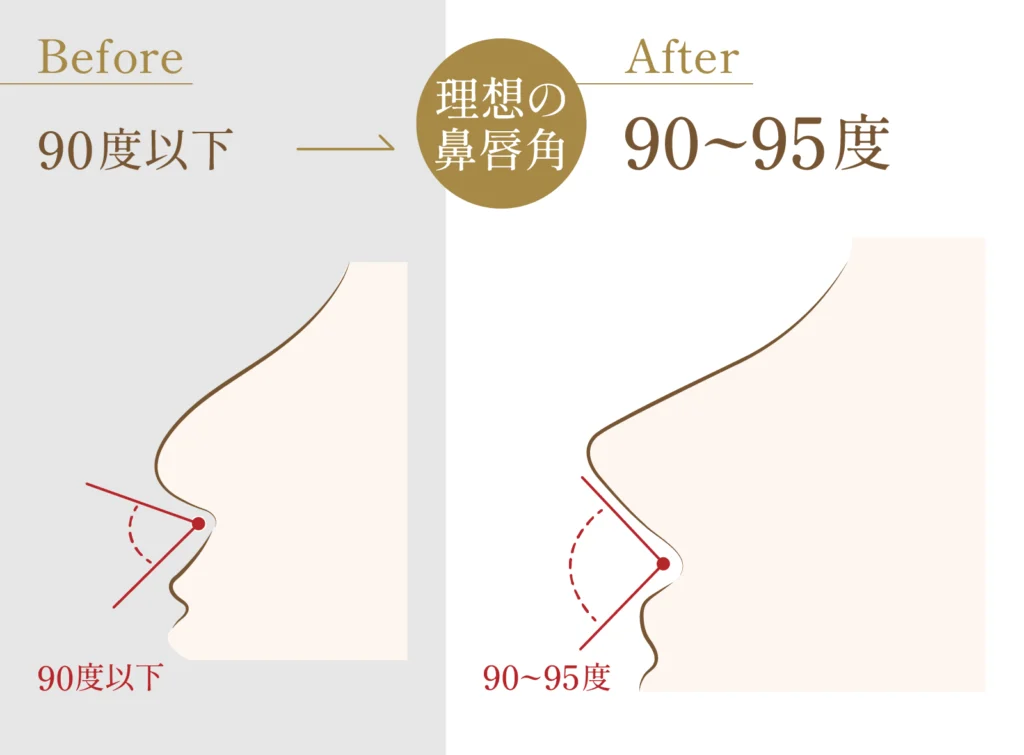 理想の鼻唇角の角度についての図解画像