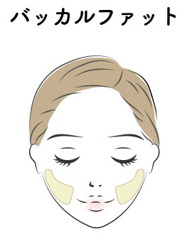 バッカルファット