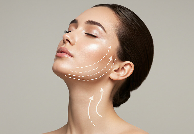 フェイスラインを整える整形