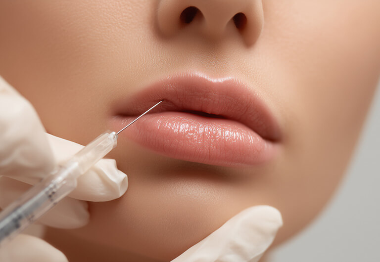 唇の全体的なボリュームアップ