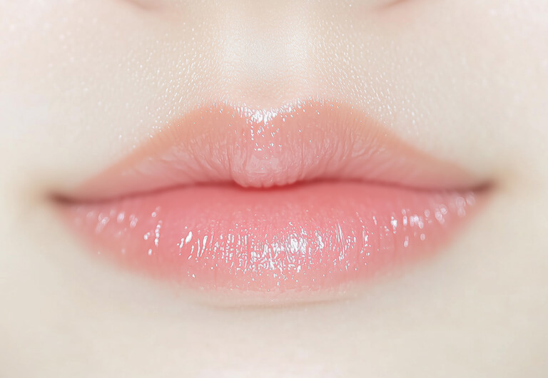 M字リップの形成