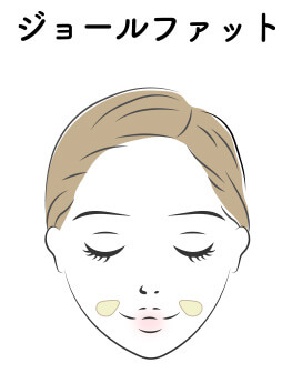 ジョールファット