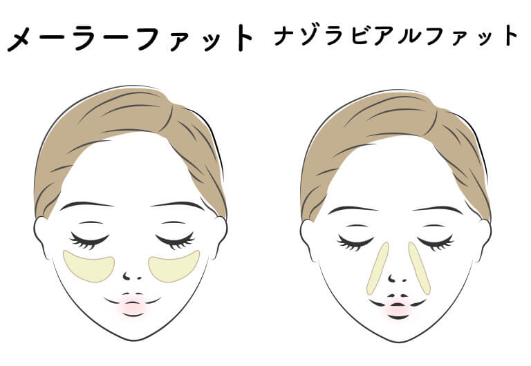 メーラーファットとナゾラビアルファット