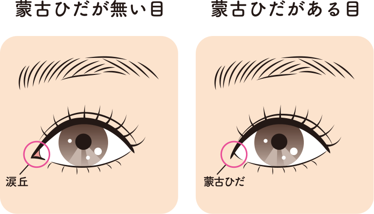「蒙古ひだ」が与える印象