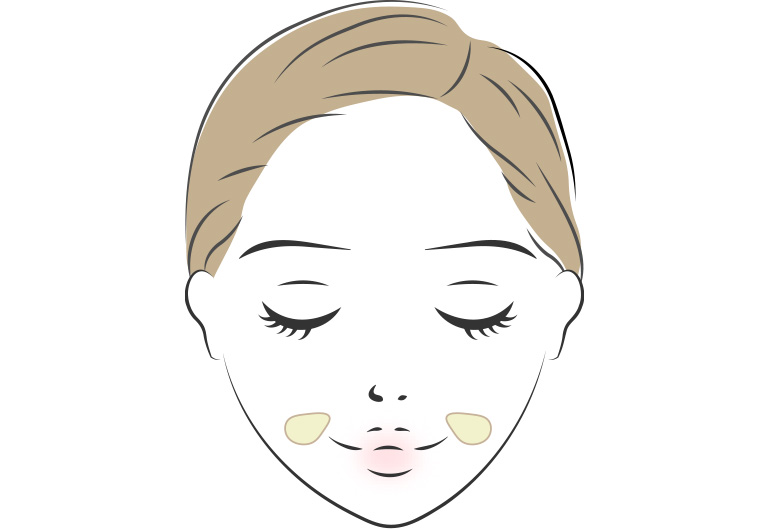 ジョールファット除去