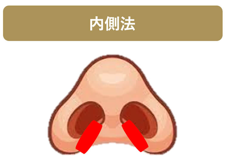 内側法