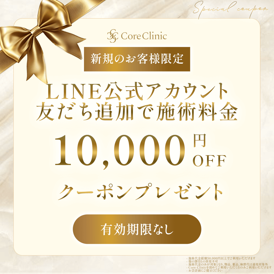 10,000円OFFクーポン