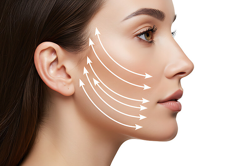 ミッドフェイスリフトとは