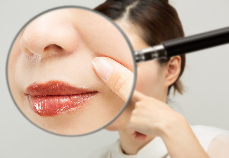 若くても目立つほうれい線の原因