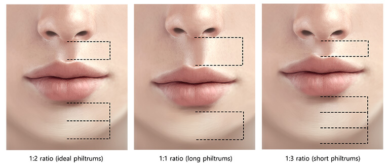 顔のバランスを大きく左右する人中