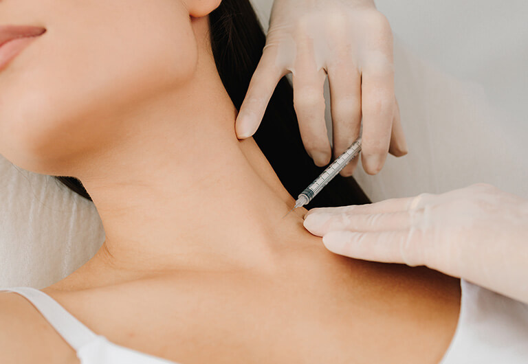 広頚筋ボトックスとは