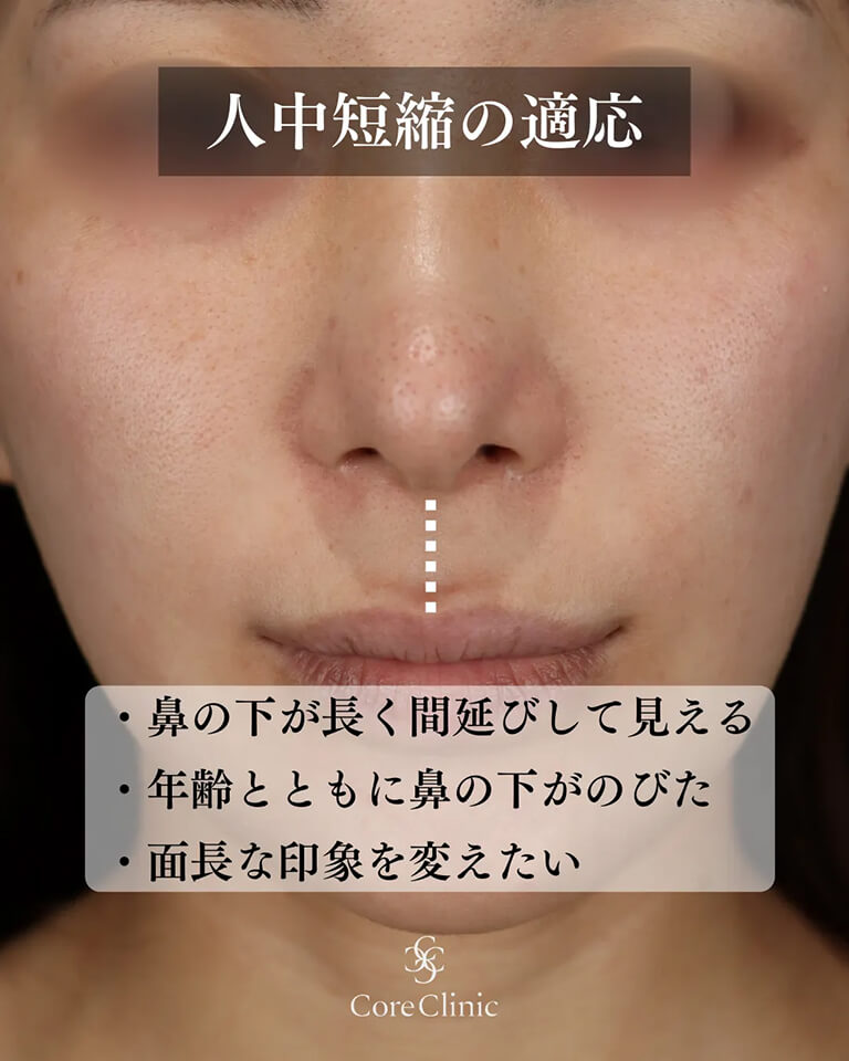 人中短縮がおすすめな人