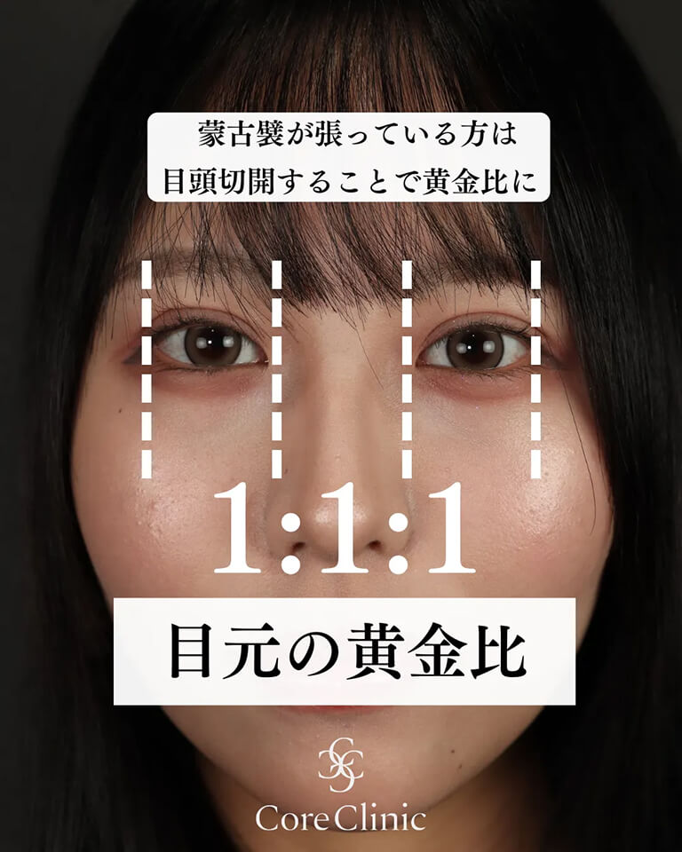 目頭切開の黄金比