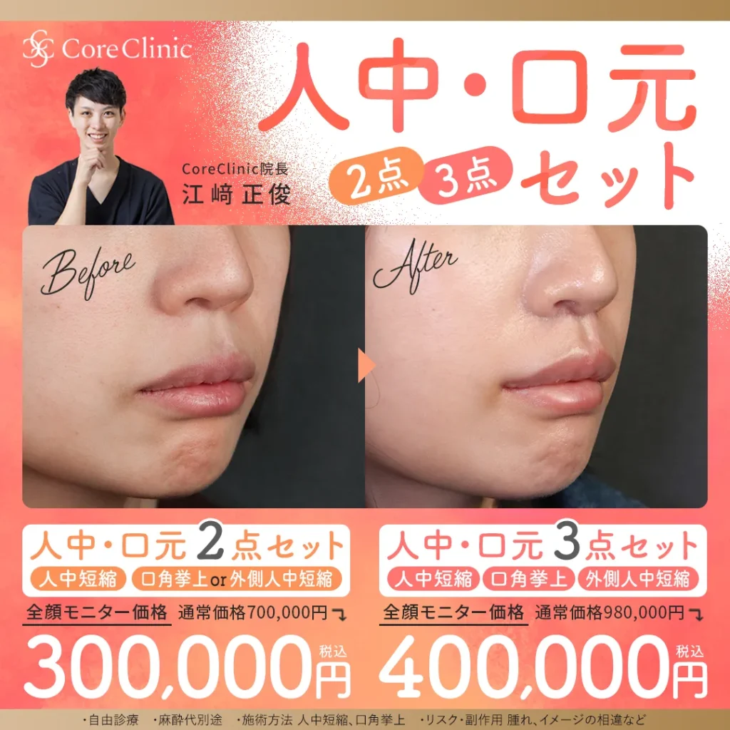 人中短縮・口角挙上・外側人中短縮の人中口元セットの症例画像