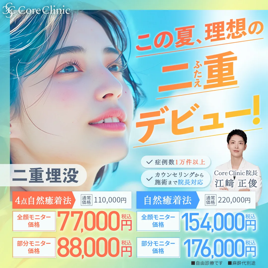 8月キャンペーン二重埋没法(自然癒着法)